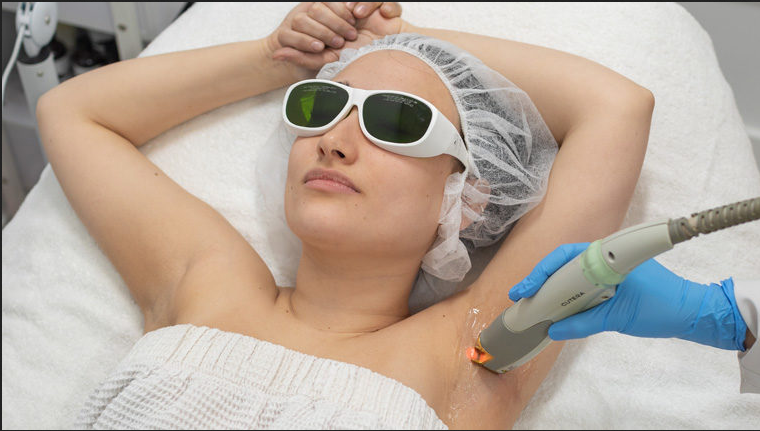 Alexandrite Laser Hair Removal In United States